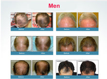 Laser Therapy Hair Growth Treatment Helmet Device