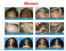 Laser Therapy Hair Growth Treatment Helmet Device